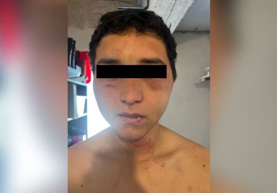 Habló el peón rural torturado por sus jefes en Vedia: "Me dijeron que me iban a paralizar el corazón"
